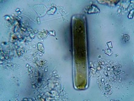 E.-coli-0157.jpg
